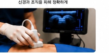 초음파 주사