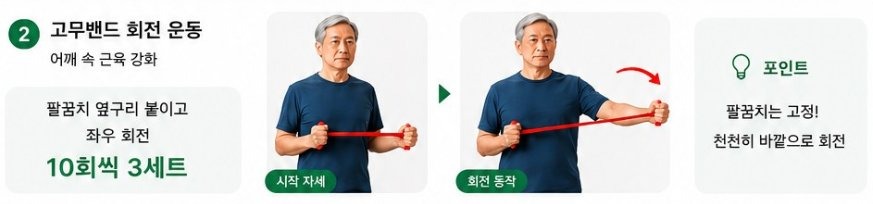 고무밴드 회전 운동 - 10회씩 3세트